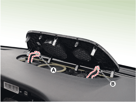 Hyundai Palisade. Repair procedures